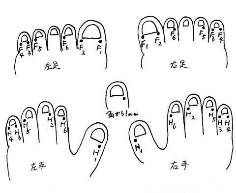 井穴刺絡研究会より